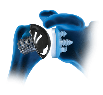 Arthrex - Arthrex ECLIPSE Humeral Head, 37/16 - AR-9337-16
